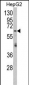 RARS2 Antibody (C-term)